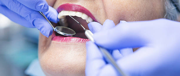 Best Broken Tooth Emergency  in Shawsville, VA